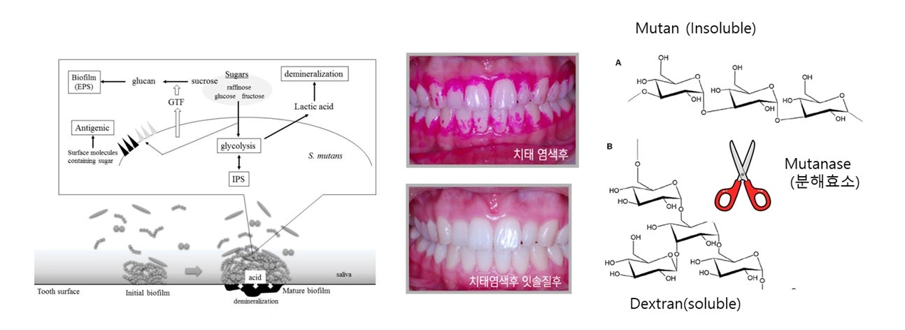 플라그 분해 효소 Mutanase